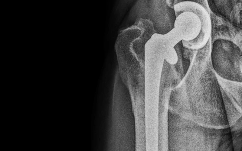 Total Hip Replacement for Dogs and Cats